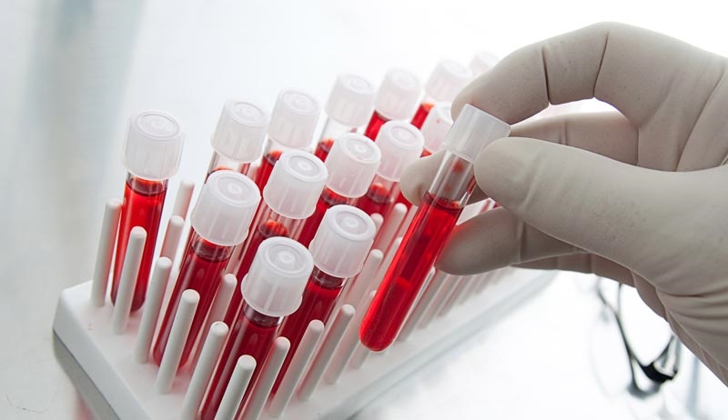 تشخیص و غربالگری در مرکز پزشکی آوان